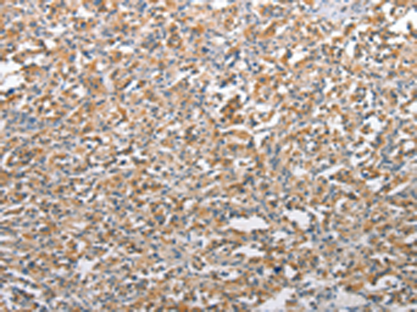  兔抗TSC2多克隆抗体 