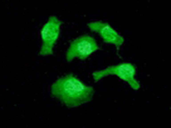 兔抗TSC22D1多克隆抗体