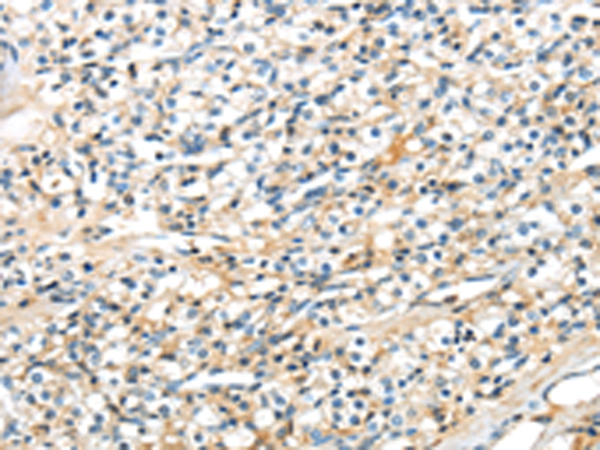 兔抗TSPYL6多克隆抗体 