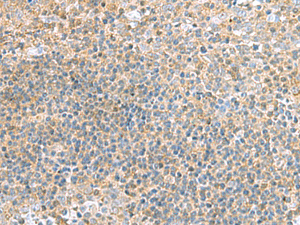 兔抗TSTA3多克隆抗体  
