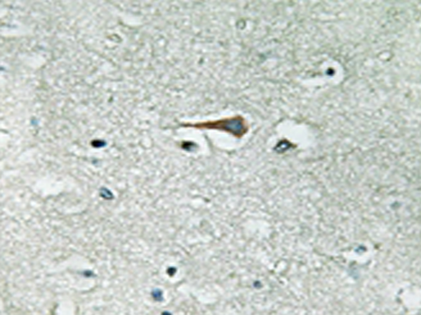 兔抗TTK(Ab-676) 多克隆抗体   
