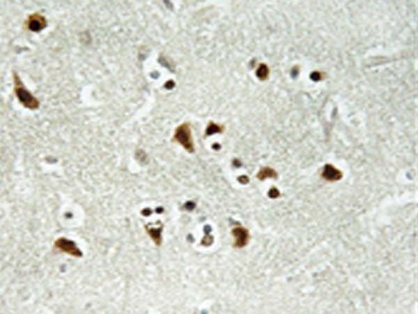 兔抗TUBGCP6多克隆抗体   