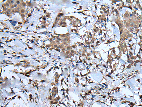 兔抗UBA52多克隆抗体 