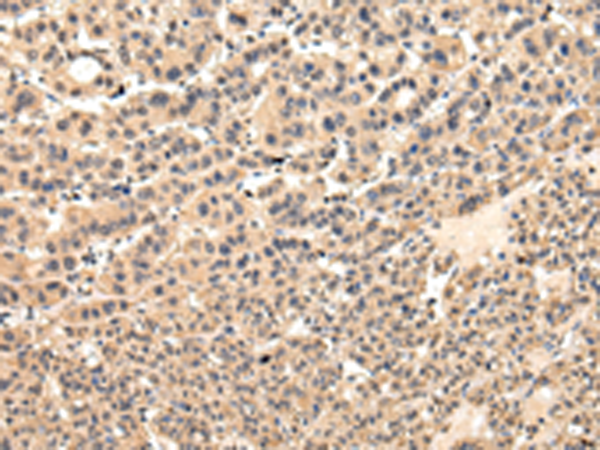 兔抗VPS37D多克隆抗体