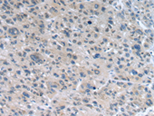 兔抗WNT10A多克隆抗体 