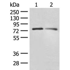 兔抗FXR2多克隆抗体   