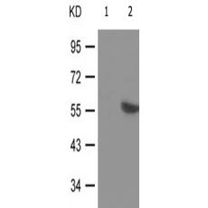 兔抗FYN(Phospho-Tyr530) 多克隆抗体 