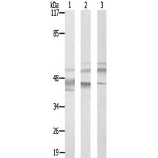 兔抗G3BP2多克隆抗体  