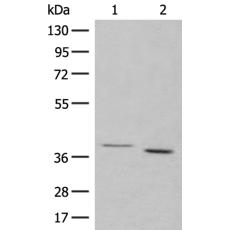 兔抗GALR1多克隆抗体