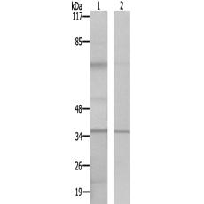 兔抗GIMAP5多克隆抗体   