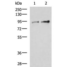 兔抗TTC14多克隆抗体 
