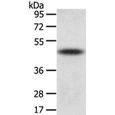 兔抗TTC23多克隆抗体   