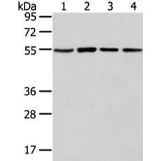 兔抗TUBA1C多克隆抗体   