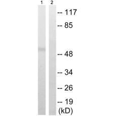 兔抗TUBA1/3/4(Phospho-Tyr272) 多克隆抗体 