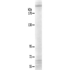 兔抗TUBGCP6多克隆抗体   