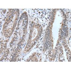 兔抗UBA52多克隆抗体 