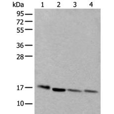 兔抗UBE2D3多克隆抗体
