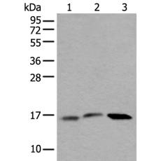 兔抗UBE2G2多克隆抗体 