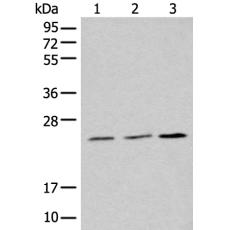 兔抗UBE2M多克隆抗体   