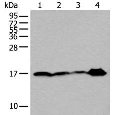 兔抗UBE2V2多克隆抗体 