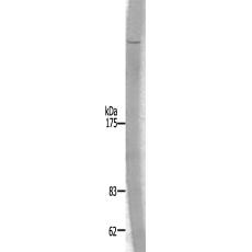  兔抗UBR5多克隆抗体