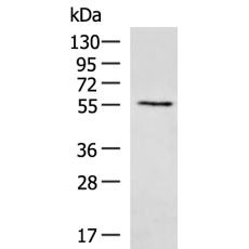 兔抗UGT2B4多克隆抗体   