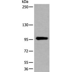 兔抗UNC45B多克隆抗体