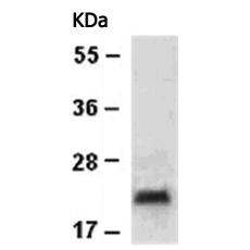 小鼠抗BIRC5单克隆抗体   