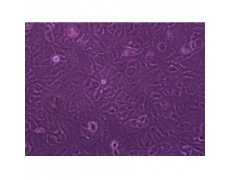 小鼠原代肾小球系膜细胞