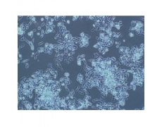 NCI-H446​人小细胞肺癌细胞