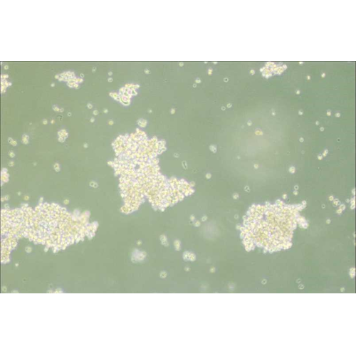 NCI-H69人小细胞肺癌细胞