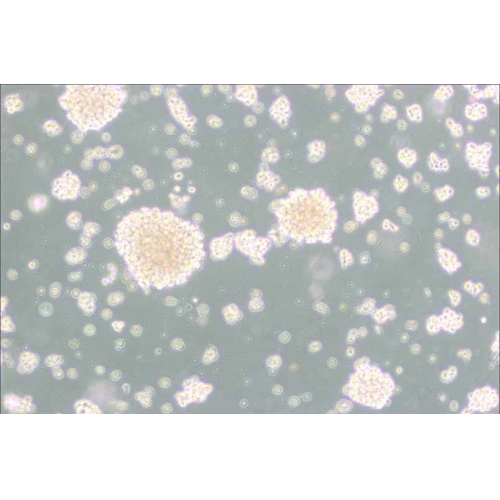 NK-92MI人恶性非霍奇金淋巴瘤患者的自然杀伤细胞