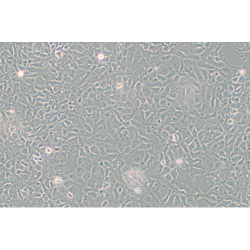 PA-1人卵巢畸胎瘤细胞