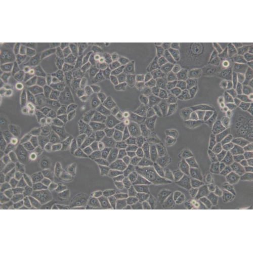 SPC-A-1人肺腺癌细胞