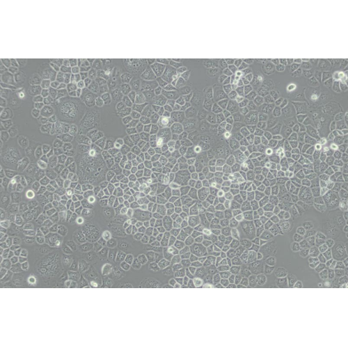 SW-13人肾上腺皮质小细胞癌细胞(DMEM)