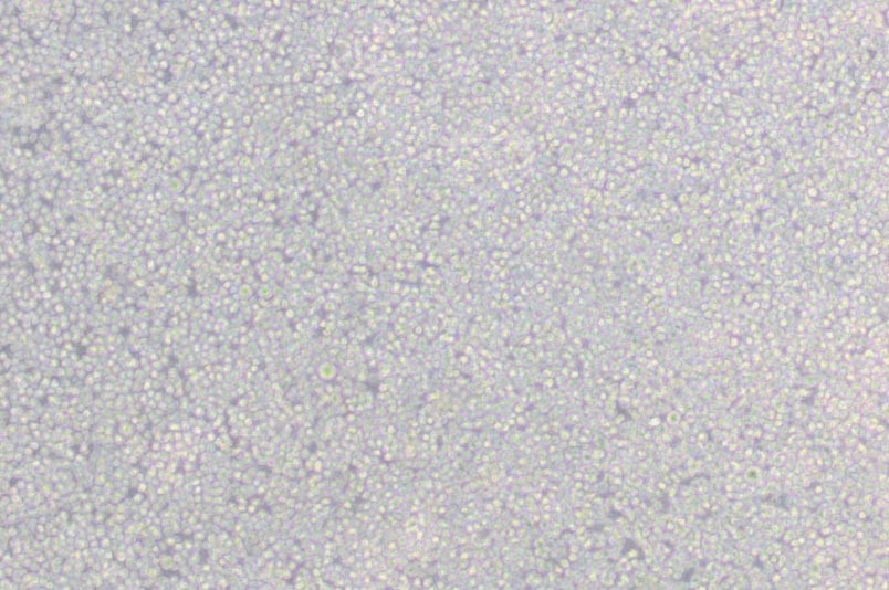6T-CEM人T细胞白血病细胞