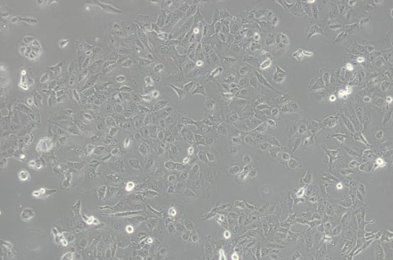 DU-145人前列腺癌细胞