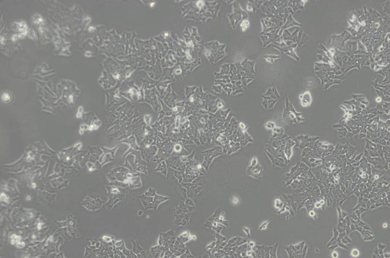 BIU-87人膀胱癌细胞