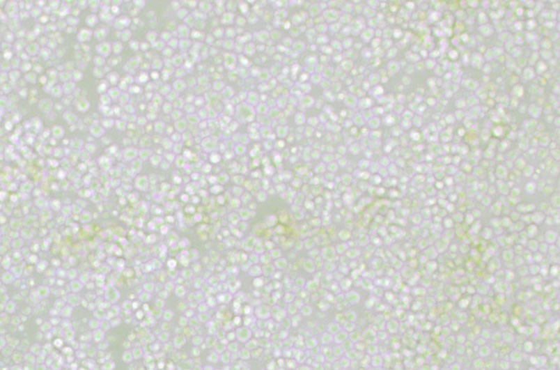 OKT 11小鼠杂交瘤细胞(抗CD2)