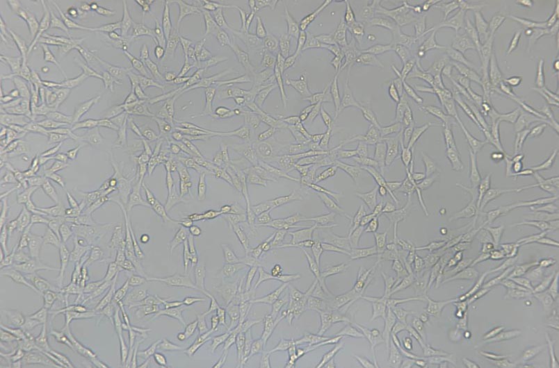 S-180小鼠腹水瘤细胞