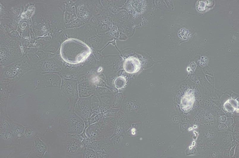 HCC1937人乳腺癌细胞