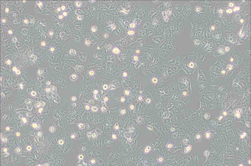 Caov-3人乳突状卵巢腺癌细胞
