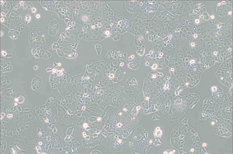 HEC-1-A人子宫内膜腺癌细胞