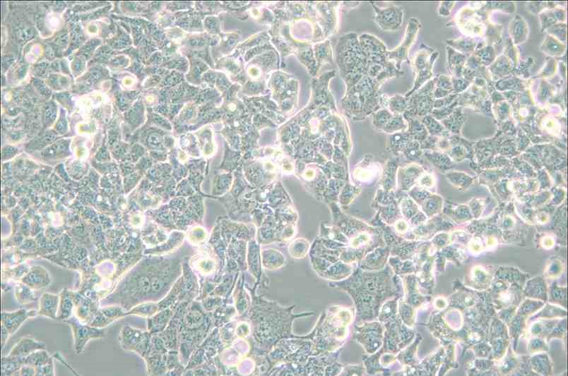 HEC-1-B人子宫内膜腺癌细胞