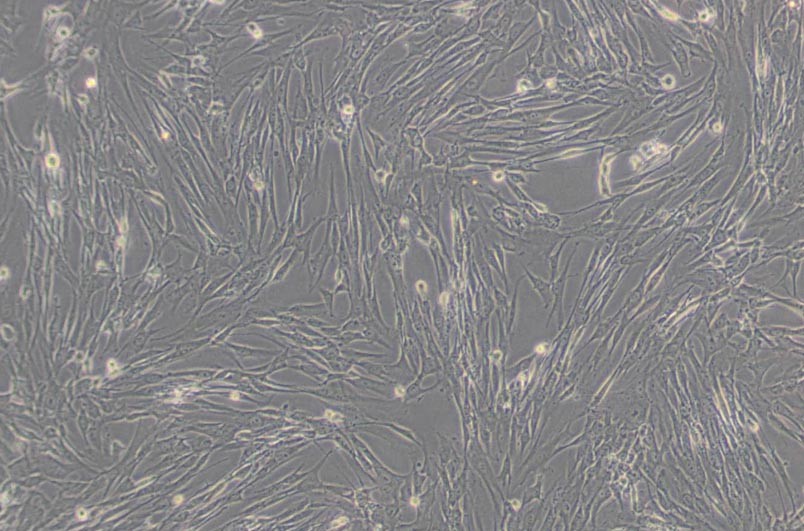 HFL1人胚肺成纤维细胞