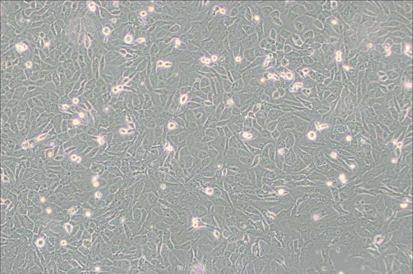 SW872人脂肪肉瘤细胞(DMEM)