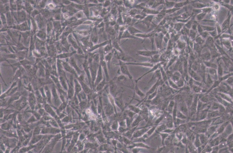 HTh-7人甲状腺癌细胞
