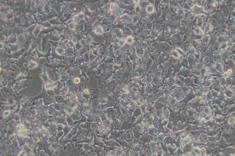 HuH-7人肝癌细胞