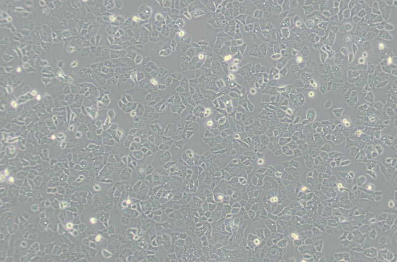 Ishikawa人子宫内膜癌细胞