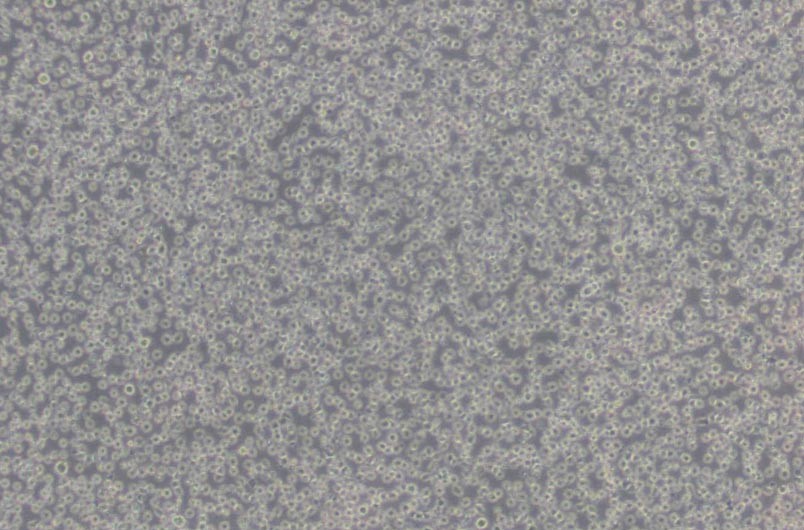 Jurkat clone A3[A3]人T淋巴细胞白血病细胞